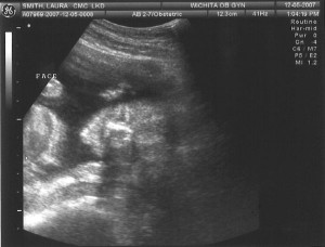 Sonogram 5 - Face