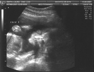 Sonogram 6 - Face