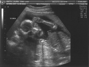 Sonogram 7 - Yawn