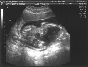 Sonogram 8 - Boy
